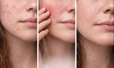 Jak porozumět své pleti a neztratit se v kosmetice